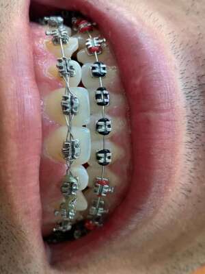 Foto Preparatoria De Estudios De Posgrado En Ortodoncia Valle De Anahuac #3